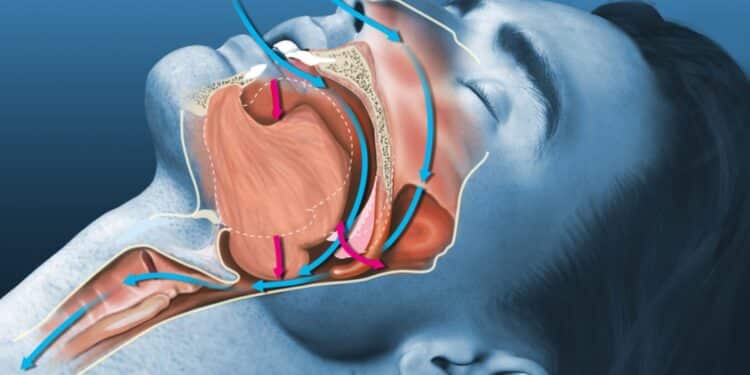تمارين الفم للتخلص من الشخير