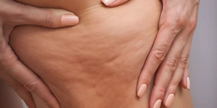 السيلولايت